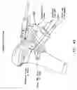 Fig. 55 - Method and apparatus for reconstructing a ligament and/or repairing cartilage, and for performing an open wedge, high tibial osteotomy