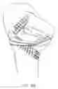 Fig. 80 - Method and apparatus for reconstructing a ligament and/or repairing cartilage, and for performing an open wedge, high tibial osteotomy