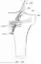 Fig. 82 - Method and apparatus for reconstructing a ligament and/or repairing cartilage, and for performing an open wedge, high tibial osteotomy