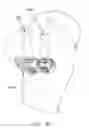 Fig. 96 - Method and apparatus for reconstructing a ligament and/or repairing cartilage, and for performing an open wedge, high tibial osteotomy