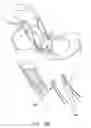 Fig. 97 - Method and apparatus for reconstructing a ligament and/or repairing cartilage, and for performing an open wedge, high tibial osteotomy