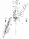 Fig. 07 - Method for blood vessel clip application