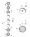 Fig. 04 - Intracorporeal occlusive device and method