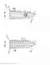 Fig. 08 - Dual thread cannulated suture anchor