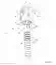 Fig. 06 - Vertebral anchoring device