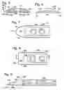 Fig. 04 - Insertion tool for bone plates