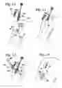 Fig. 05 - Insertion tool for bone plates