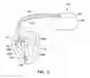 Fig. 03 - System providing ventricular pacing and biventricular coordination