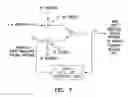 Fig. 08 - System providing ventricular pacing and biventricular coordination