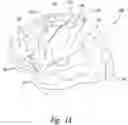 Fig. 02 - Electrode Configurations for Reducing Invasiveness and/or Enhancing Neural Stimulation Efficacy, and Associated Methods
