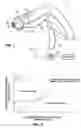Fig. 02 - Method of using cryogenic compositions for cooling heated skin
