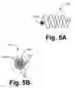 Fig. 07 - Medical electrical lead