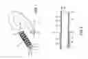 Fig. 02 - Stented vascular graft