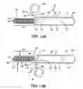 Fig. 08 - Stented vascular graft