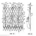 Fig. 02 - Everting heart valve