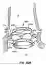 Fig. 49 - Everting heart valve