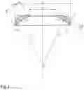 Fig. 02 - Cornea implant
