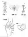 Fig. 03 - Artificial ligaments for joint applications