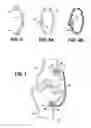 Fig. 04 - Artificial ligaments for joint applications