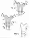Fig. 07 - Artificial ligaments for joint applications