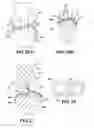 Fig. 09 - Artificial ligaments for joint applications