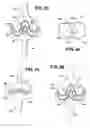 Fig. 10 - Artificial ligaments for joint applications