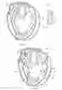 Fig. 02 - Baseball Glove with Illuminated Target Area