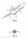Fig. 02 - Beater cleaner