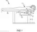 Fig. 02 - COMPUTED TOMOGRAPHY BREAST IMAGING AND BIOPSY SYSTEM