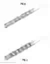 Fig. 04 - Bend Stiffener
