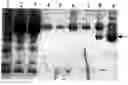 Fig. 01 - Tissue factor antibodies and uses thereof