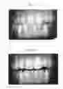 Fig. 02 - Sustained Release Dosage Forms For Delivery of Agents to an Oral Cavity of a User