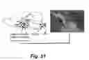 Fig. 52 - Insulin-responsive DNA binding proteins-1 and methods to regulate insulin-responsive genes
