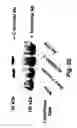 Fig. 72 - Insulin-responsive DNA binding proteins-1 and methods to regulate insulin-responsive genes