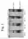 Fig. 02 - Method for enriching short-chain nucleic acids