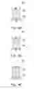 Fig. 06 - Patterning method
