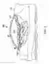 Fig. 02 - INFLATABLE MEDICAL DEVICE