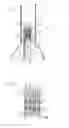Fig. 02 - ALIGNMENT STENT APPARATUS AND METHOD