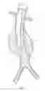 Fig. 02 - Catheter-based fastener implantation apparatus and methods