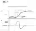 Fig. 08 - Select Assist Device for Automatic Transmission