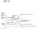 Fig. 19 - Select Assist Device for Automatic Transmission
