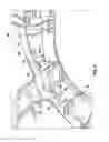 Fig. 06 - Clothes dryer drum bearing assembly
