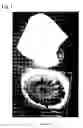 Fig. 02 - Facial tissue container with integrated night light