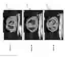 Fig. 04 - Systems and methods for image processing of 2D medical images