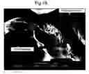 Fig. 22 - Particle stabilised emulsion composition