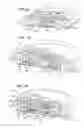 Fig. 10 - Disposable infusion device with dual valve system