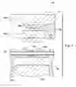 Fig. 06 - Method and clamping apparatus for external fixation and stabilization