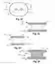 Fig. 11 - Orthopedic device assembly with elements coupled by a retaining structure