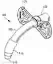 Fig. 01 - Balloon cuff tracheostomy tube