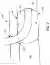 Fig. 06 - Balloon cuff tracheostomy tube
